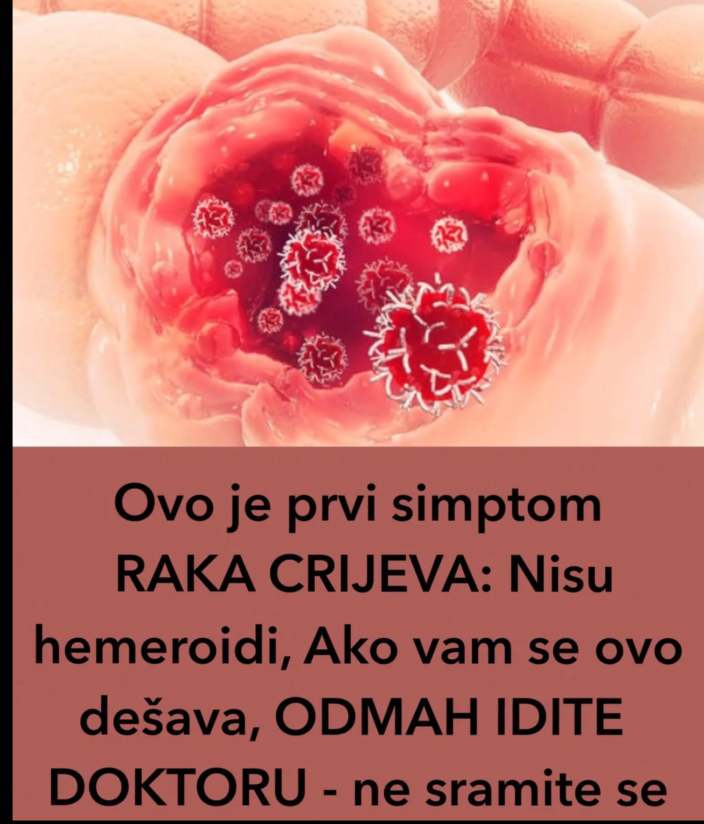 Ovo Je Prvi Simptom RAKA CRIJEVA: Nisu Hemeroidi, Ako Vam Se Ovo Dešava ...