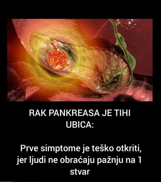 Rak Pankreasa Je Tihi Ubica Merima Je Danas Preminula A Ovo Su Hot Sex Picture